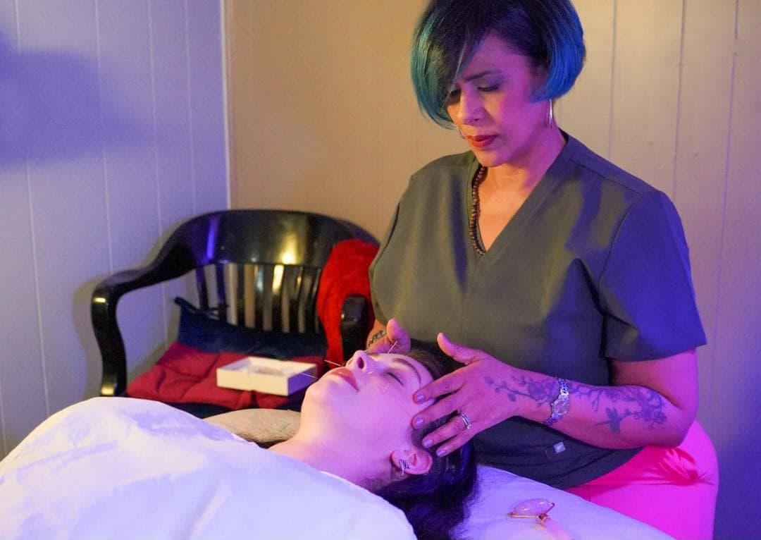 Dr. Yolanda Vasquez performing acupuncture restoration